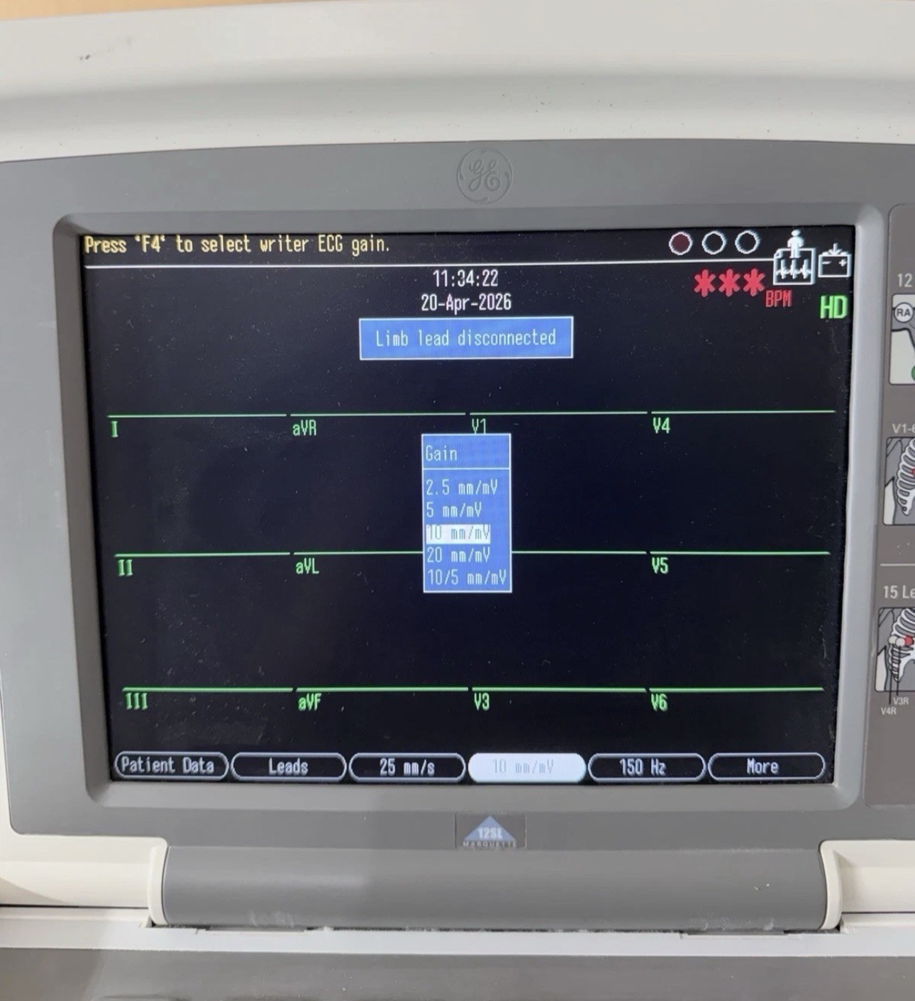 GE MAC 5500 HD System w/ CAM-14 HD, SX-500 Wireless Module & Mobile Cart